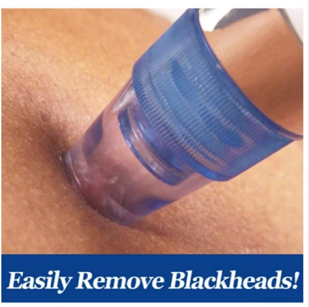 Pore And Blackhead  Cleaning Device
